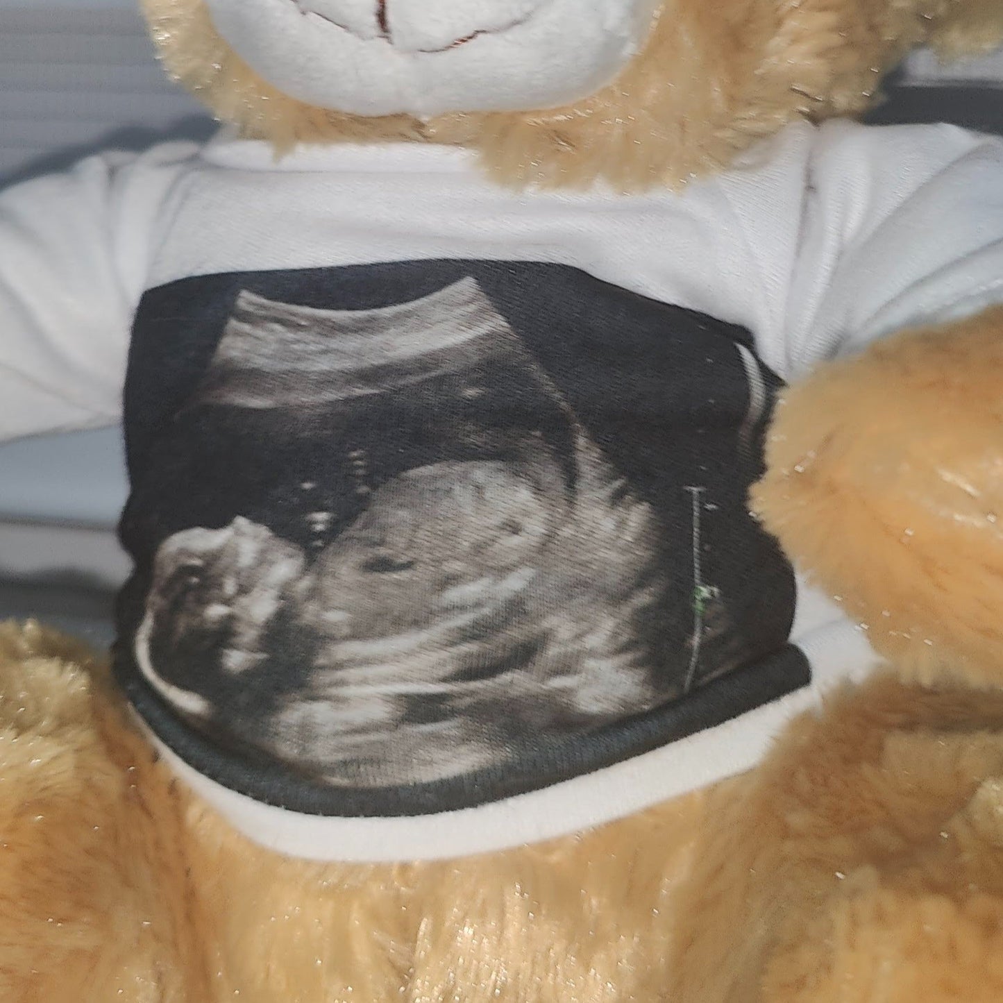 ultrasound bear personalised Only Bear