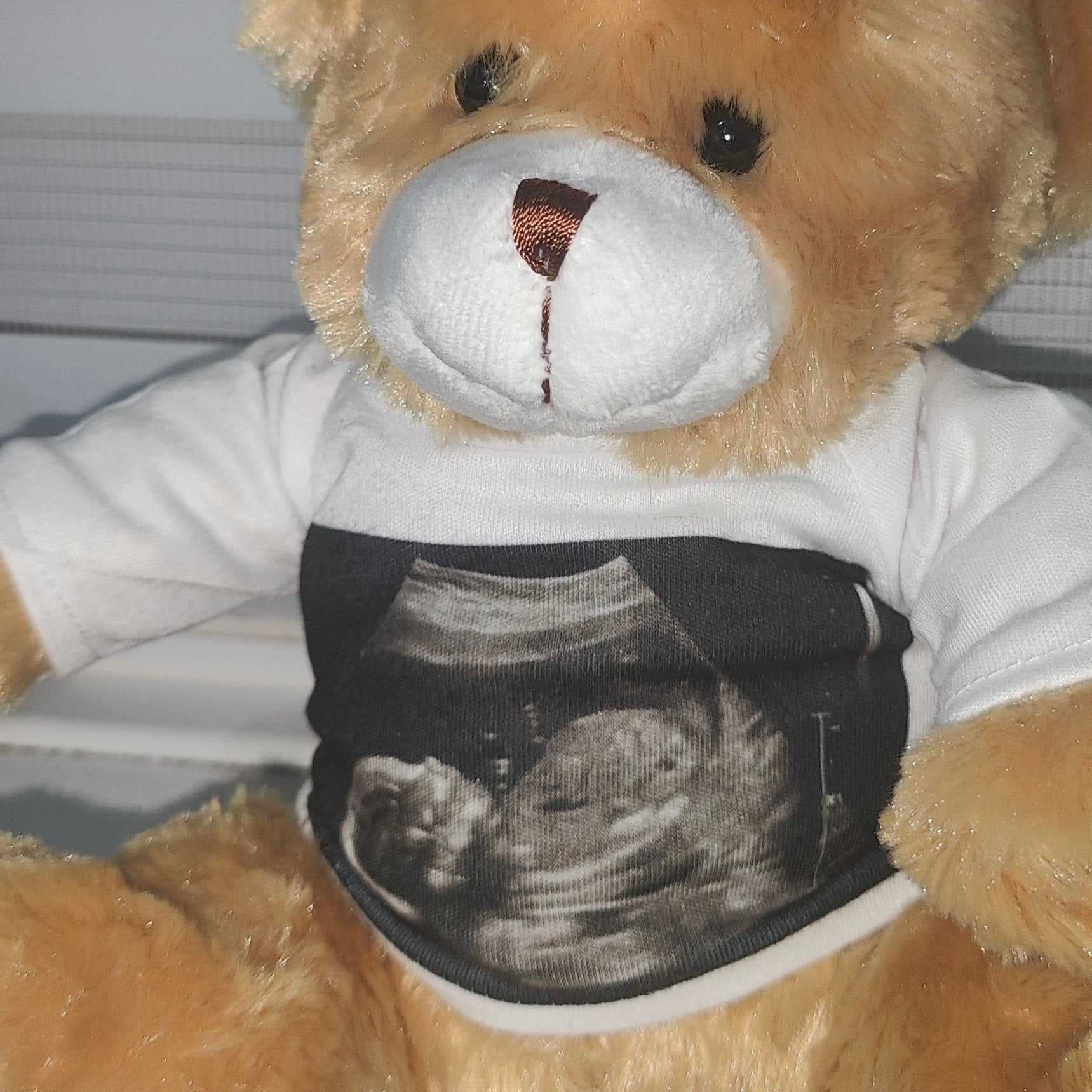 ultrasound on a teddy bear 